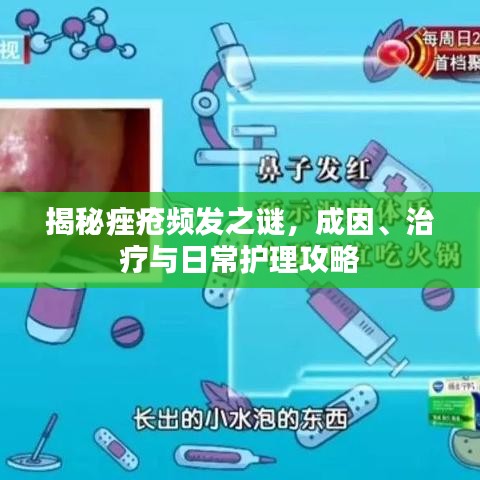揭秘痤疮频发之谜，成因、治疗与日常护理攻略